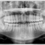 radiologia_panoramico_owandy_i_max_imagen_clinica_03.jpg