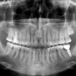 radiologia_panoramico_owandy_i_max_imagen_clinica_01.jpg